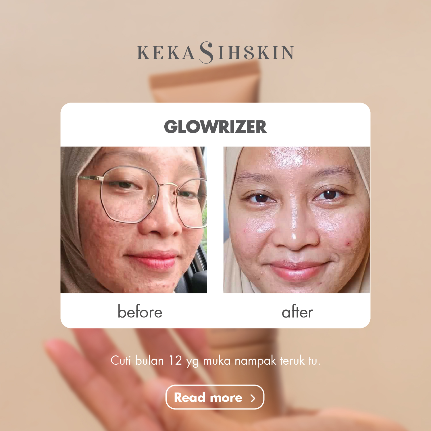 Glowrizer before and after testimonial result