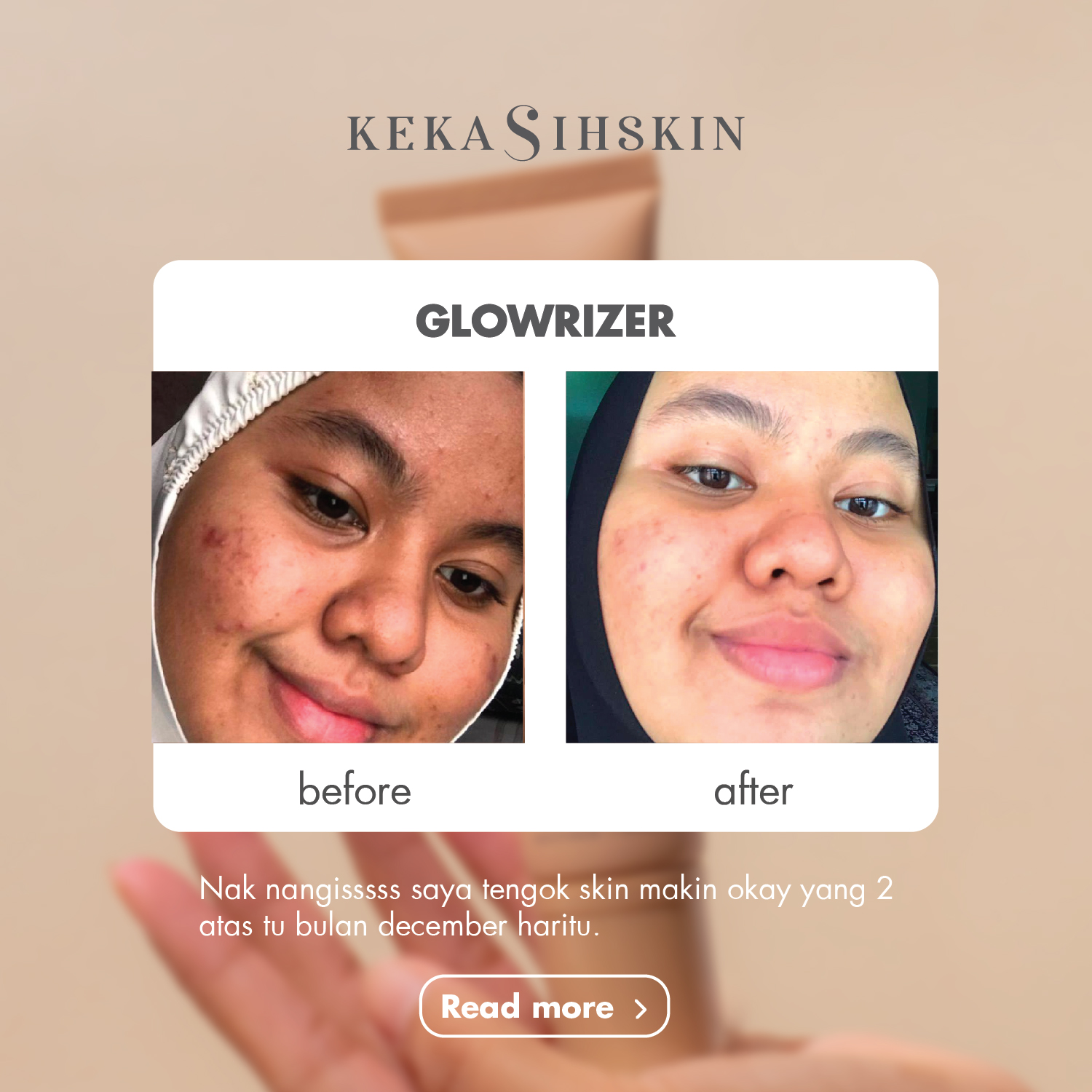 Glowrizer before and after skin improvement result